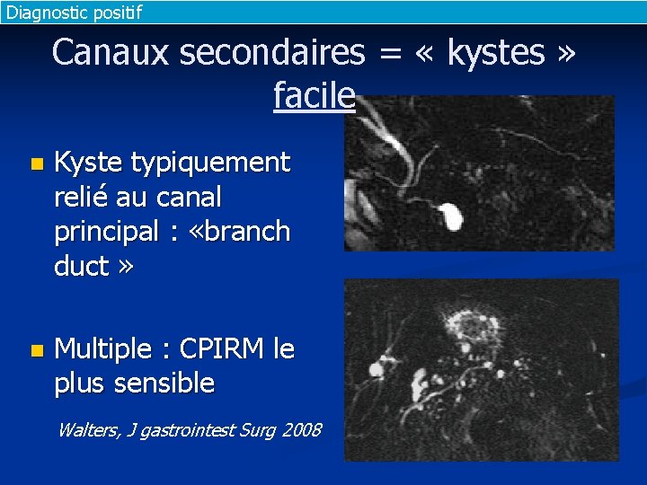 Diagnostic positif Canaux secondaires = « kystes » facile n Kyste typiquement relié au Diagnostic positif Canaux secondaires = « kystes » facile n Kyste typiquement relié au