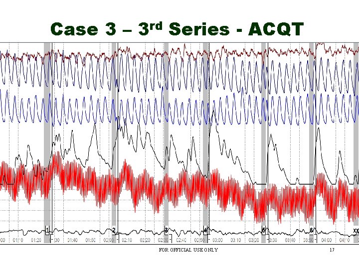 Case 3 – 3 rd Series - ACQT FOR OFFICIAL USE ONLY 17 