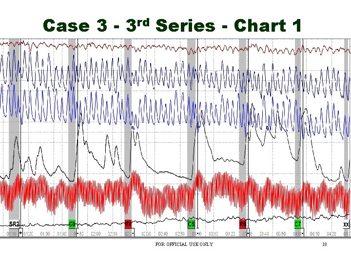 Case 3 - 3 rd Series - Chart 1 FOR OFFICIAL USE ONLY 18