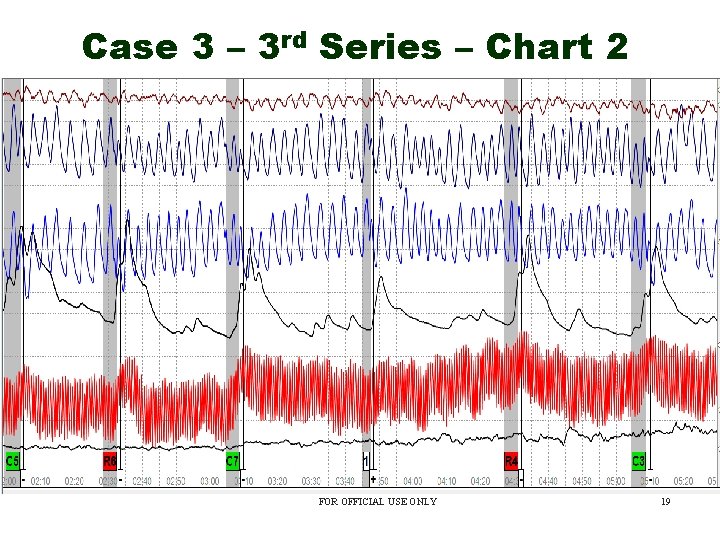 Case 3 – 3 rd Series – Chart 2 FOR OFFICIAL USE ONLY 19