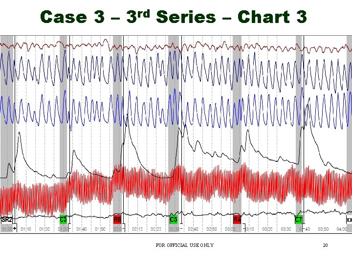 Case 3 – 3 rd Series – Chart 3 FOR OFFICIAL USE ONLY 20