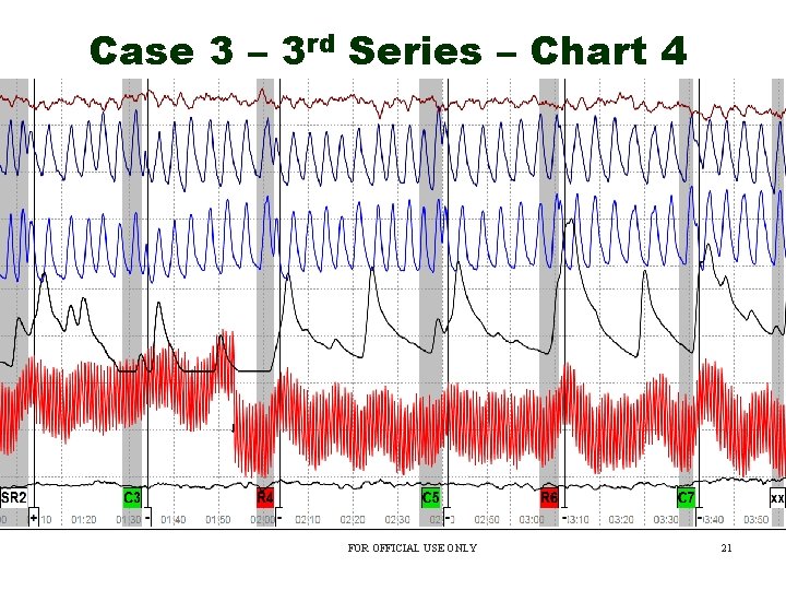 Case 3 – 3 rd Series – Chart 4 FOR OFFICIAL USE ONLY 21