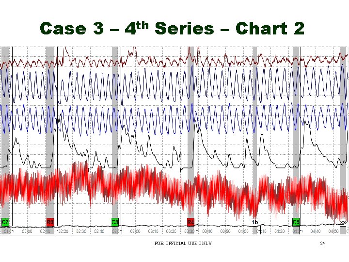 Case 3 – 4 th Series – Chart 2 FOR OFFICIAL USE ONLY 24