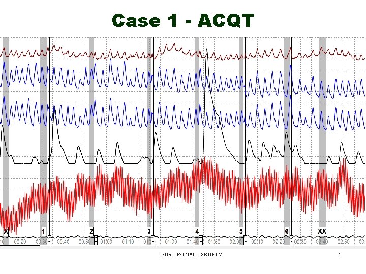 Case 1 - ACQT FOR OFFICIAL USE ONLY 4 