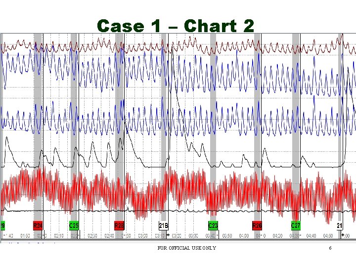 Case 1 – Chart 2 FOR OFFICIAL USE ONLY 6 
