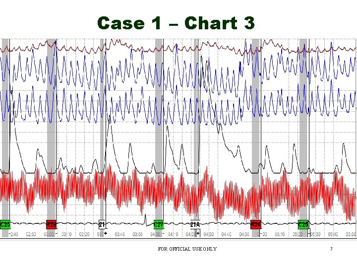 Case 1 – Chart 3 FOR OFFICIAL USE ONLY 7 