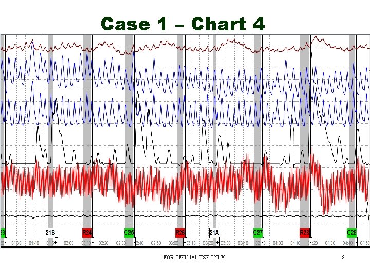 Case 1 – Chart 4 FOR OFFICIAL USE ONLY 8 