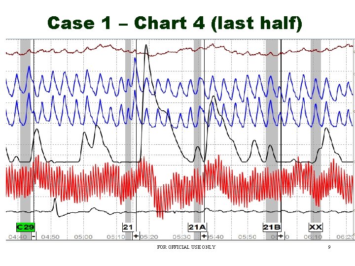 Case 1 – Chart 4 (last half) FOR OFFICIAL USE ONLY 9 