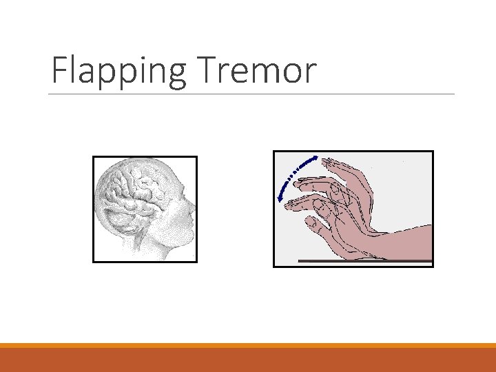 Flapping Tremor 