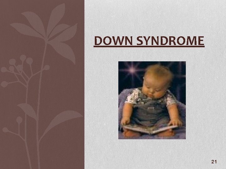 DOWN SYNDROME 21 