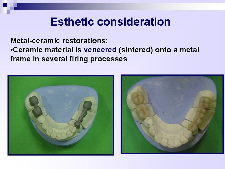 Esthetic consideration Metal-ceramic restorations: • Ceramic material is veneered (sintered) onto a metal frame