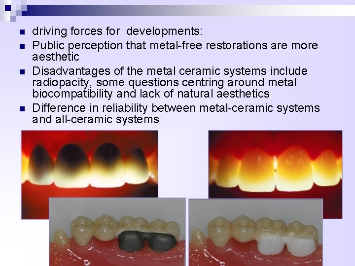 n n driving forces for developments: Public perception that metal-free restorations are more aesthetic