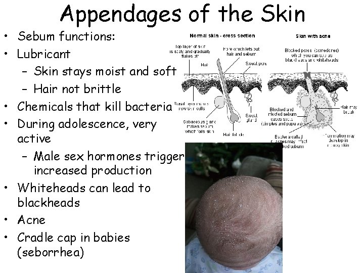 Appendages of the Skin • Sebum functions: • Lubricant – Skin stays moist and Appendages of the Skin • Sebum functions: • Lubricant – Skin stays moist and