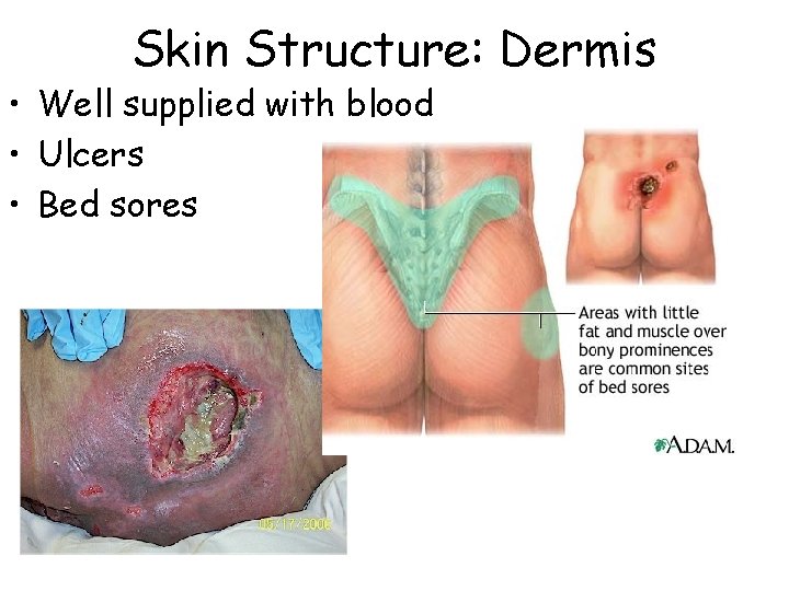 Skin Structure: Dermis • Well supplied with blood • Ulcers • Bed sores 