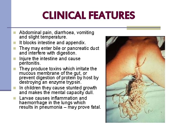 CLINICAL FEATURES n Abdominal pain, diarrhoea, vomiting n n n and slight temperature. It
