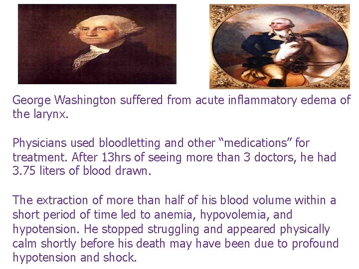 George Washington suffered from acute inflammatory edema of the larynx. Physicians used bloodletting and