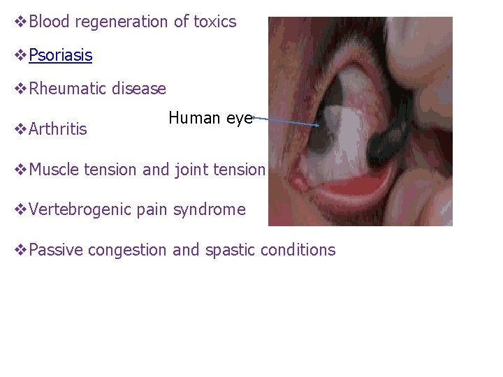 v. Blood regeneration of toxics v. Psoriasis v. Rheumatic disease v. Arthritis Human eye