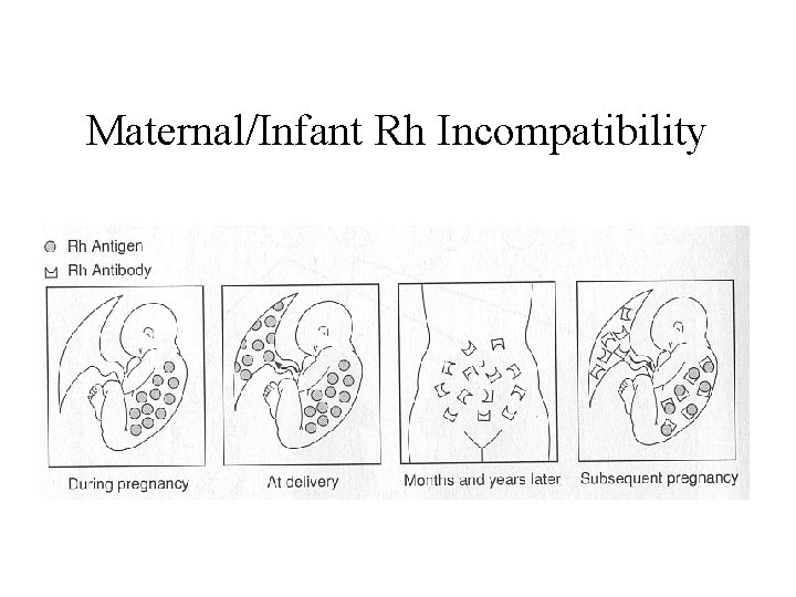 Maternal/Infant Rh Incompatibility 