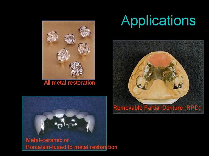 Applications All metal restoration Removable Partial Denture (RPD) Metal-ceramic or Porcelain-fused to metal restoration