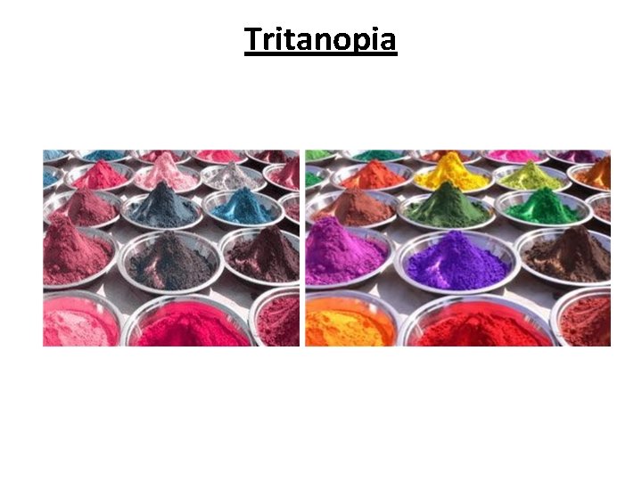 Tritanopia 