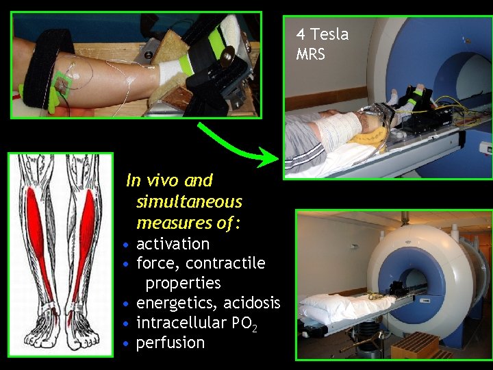 4 Tesla MRS In vivo and simultaneous measures of: • activation • force, contractile