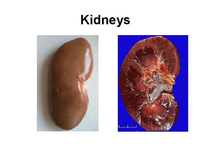 Kidneys 