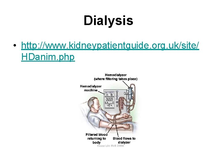 Dialysis • http: //www. kidneypatientguide. org. uk/site/ HDanim. php 