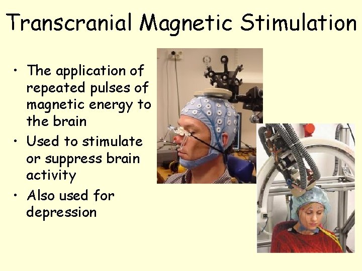 Transcranial Magnetic Stimulation • The application of repeated pulses of magnetic energy to the Transcranial Magnetic Stimulation • The application of repeated pulses of magnetic energy to the