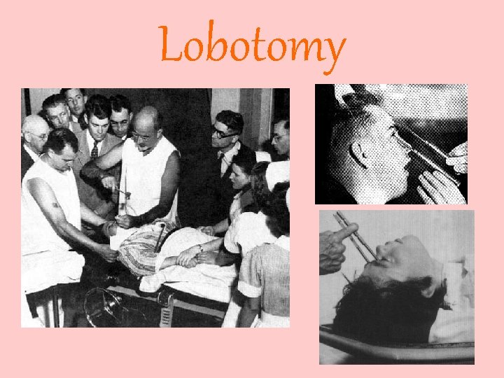 Lobotomy 