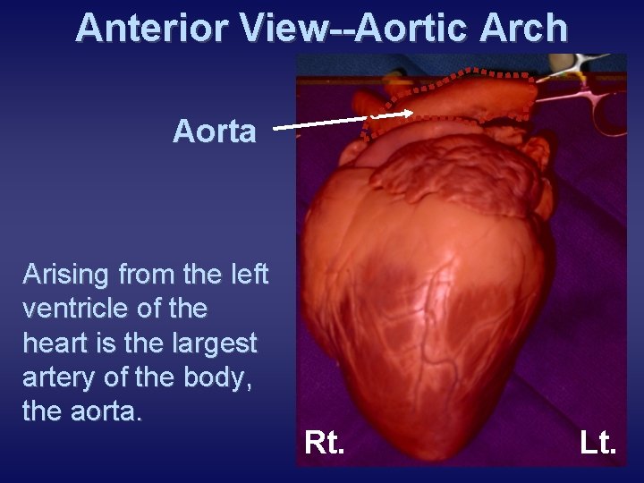 Anterior View--Aortic Arch Aorta Arising from the left ventricle of the heart is the