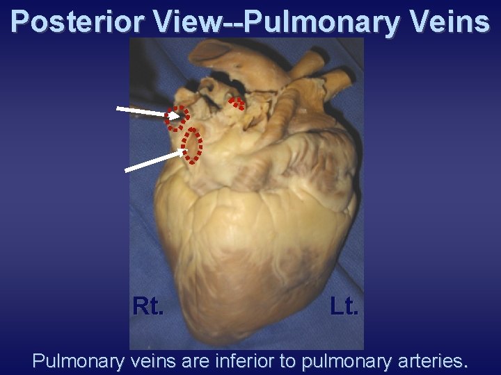 Posterior View--Pulmonary Veins Rt. Lt. Pulmonary veins are inferior to pulmonary arteries. 