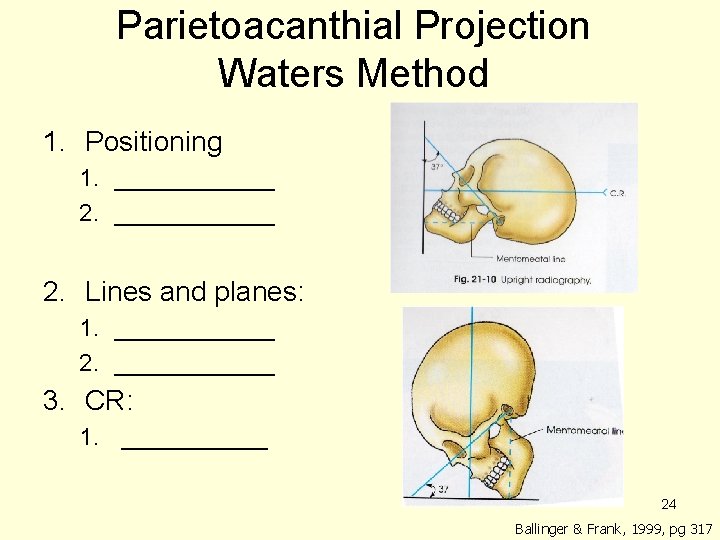 Parietoacanthial Projection Waters Method 1. Positioning 1. ____________ 2. Lines and planes: 1. ______