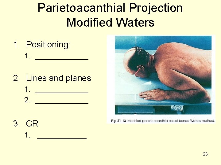 Parietoacanthial Projection Modified Waters 1. Positioning: 1. _______ 2. Lines and planes 1. _______