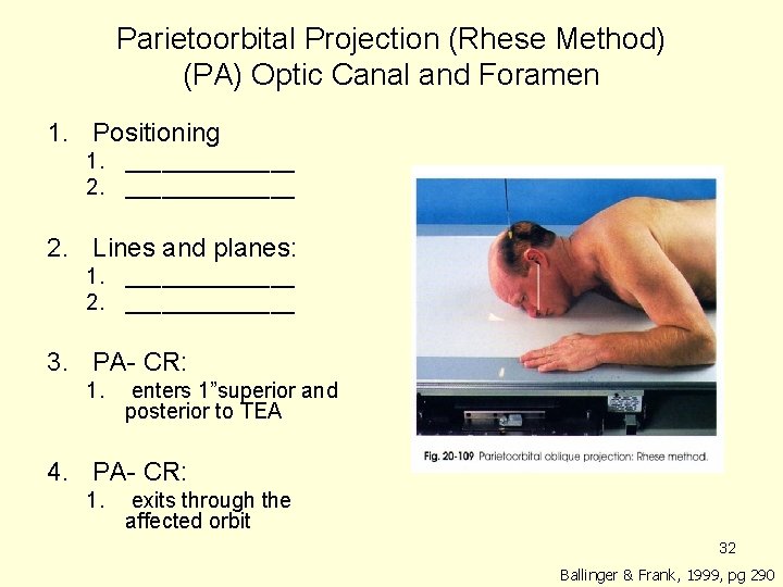 Parietoorbital Projection (Rhese Method) (PA) Optic Canal and Foramen 1. Positioning 1. ______________ 2. Parietoorbital Projection (Rhese Method) (PA) Optic Canal and Foramen 1. Positioning 1. ______________ 2.