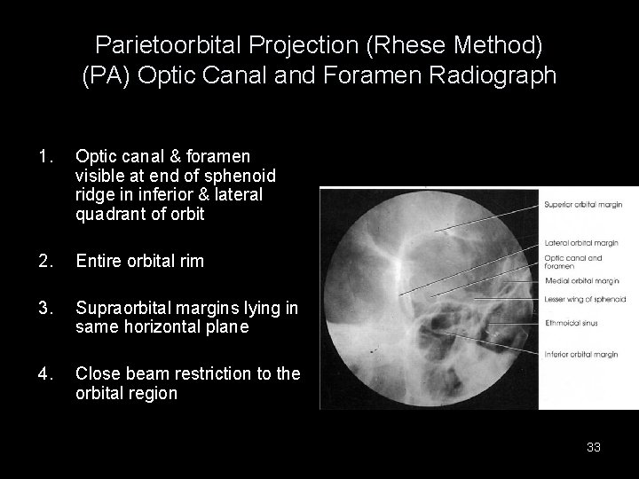 Parietoorbital Projection (Rhese Method) (PA) Optic Canal and Foramen Radiograph 1. Optic canal & Parietoorbital Projection (Rhese Method) (PA) Optic Canal and Foramen Radiograph 1. Optic canal &