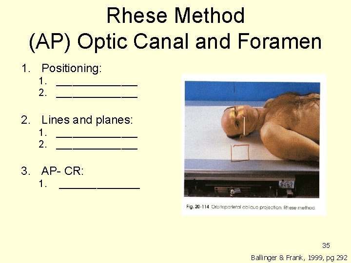 Rhese Method (AP) Optic Canal and Foramen 1. Positioning: 1. _______________ 2. Lines and