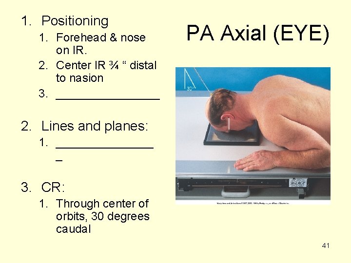 1. Positioning 1. Forehead & nose on IR. 2. Center IR ¾ “ distal