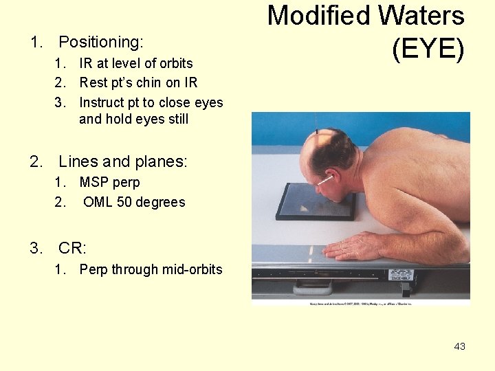 1. Positioning: 1. IR at level of orbits 2. Rest pt’s chin on IR