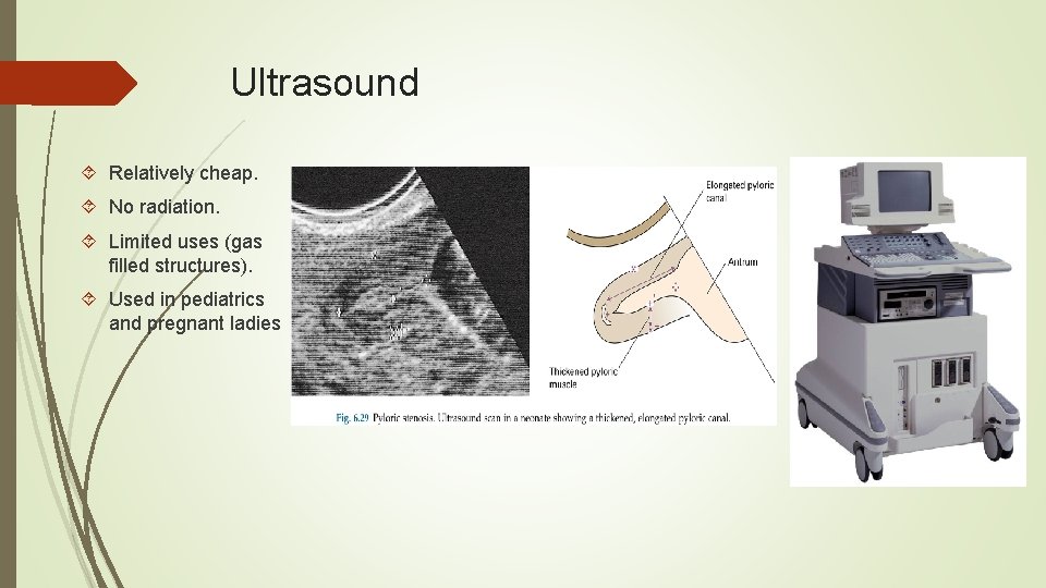 Ultrasound Relatively cheap. No radiation. Limited uses (gas filled structures). Used in pediatrics and
