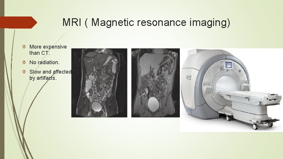 MRI ( Magnetic resonance imaging) More expensive than CT. No radiation. Slow and affected