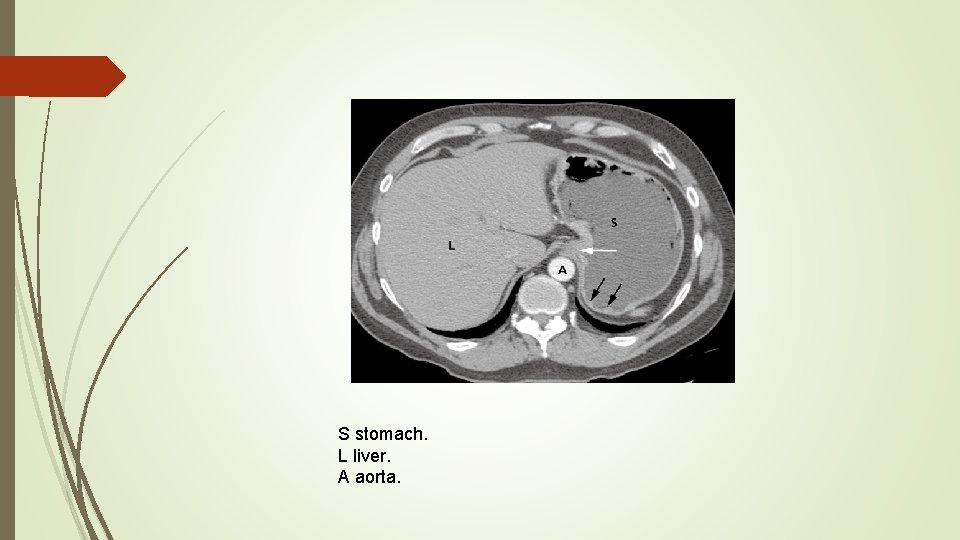 S stomach. L liver. A aorta. 