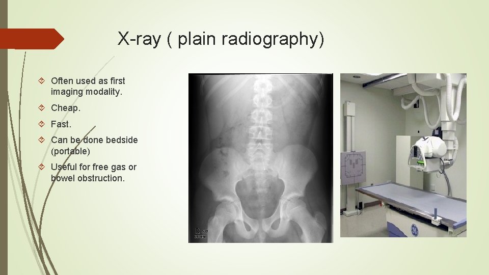X-ray ( plain radiography) Often used as first imaging modality. Cheap. Fast. Can be