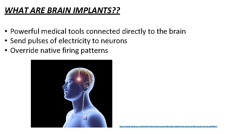 WHAT ARE BRAIN IMPLANTS? ? • Powerful medical tools connected directly to the brain