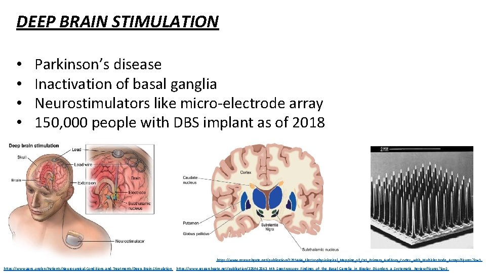 DEEP BRAIN STIMULATION • • Parkinson’s disease Inactivation of basal ganglia Neurostimulators like micro-electrode