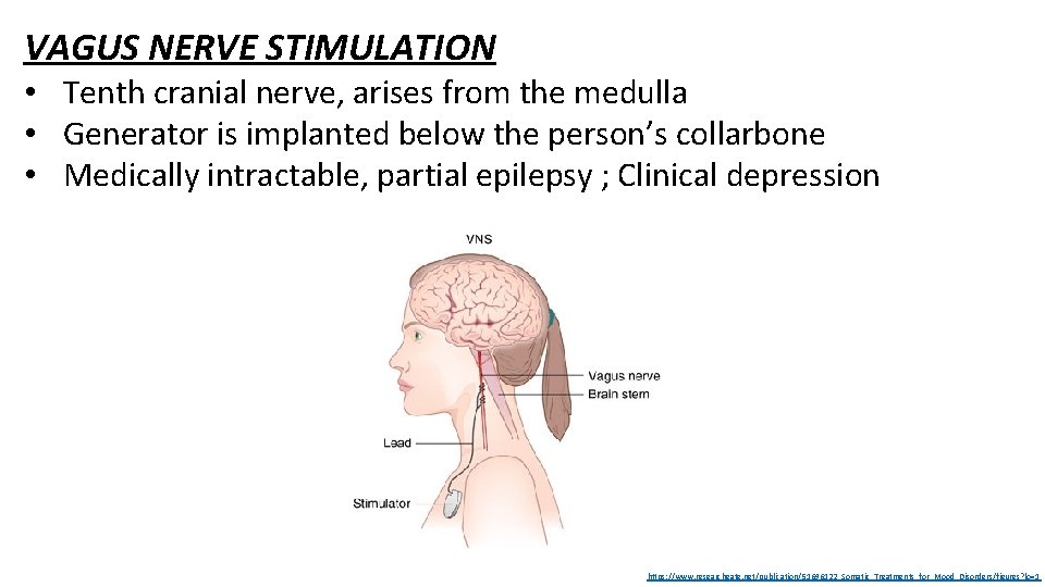 VAGUS NERVE STIMULATION • Tenth cranial nerve, arises from the medulla • Generator is