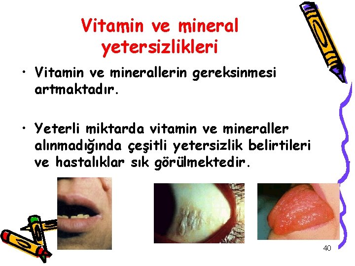 Vitamin ve mineral yetersizlikleri • Vitamin ve minerallerin gereksinmesi artmaktadır. • Yeterli miktarda vitamin