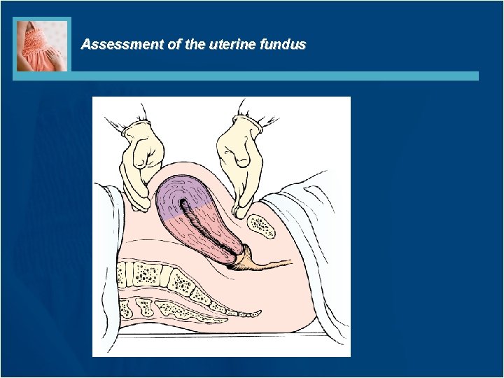 Assessment of the uterine fundus Assessment of the uterine fundus