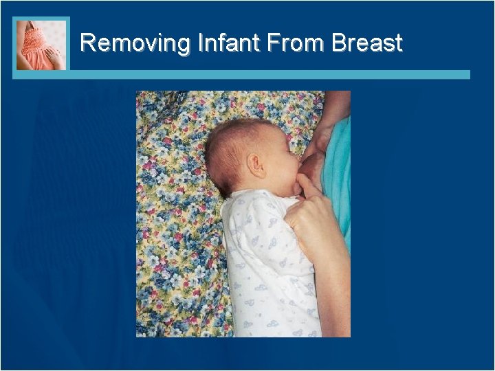 Removing Infant From Breast 