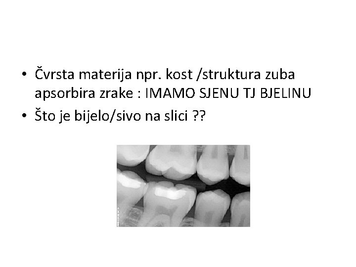  • Čvrsta materija npr. kost /struktura zuba apsorbira zrake : IMAMO SJENU TJ