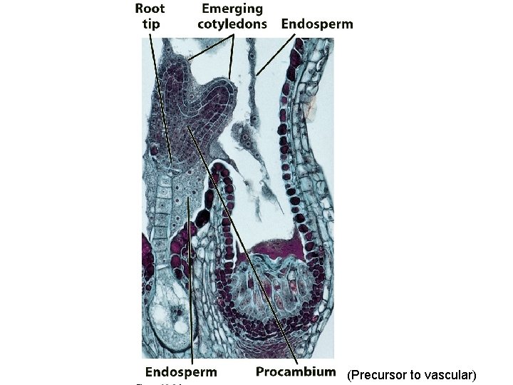 (Precursor to vascular) 